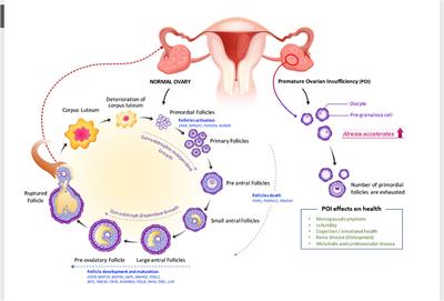 Premature Ovarian Insufficiency: Past, Present, and Future